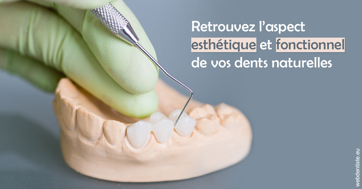 https://dr-domngang-olivier.chirurgiens-dentistes.fr/Restaurations dentaires 1