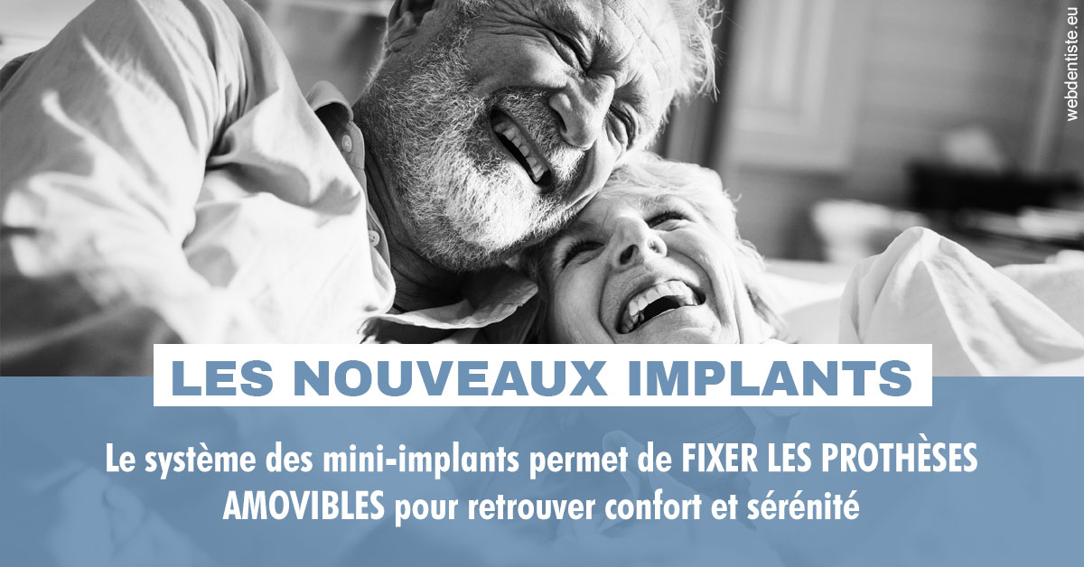 https://dr-domngang-olivier.chirurgiens-dentistes.fr/Les nouveaux implants 2