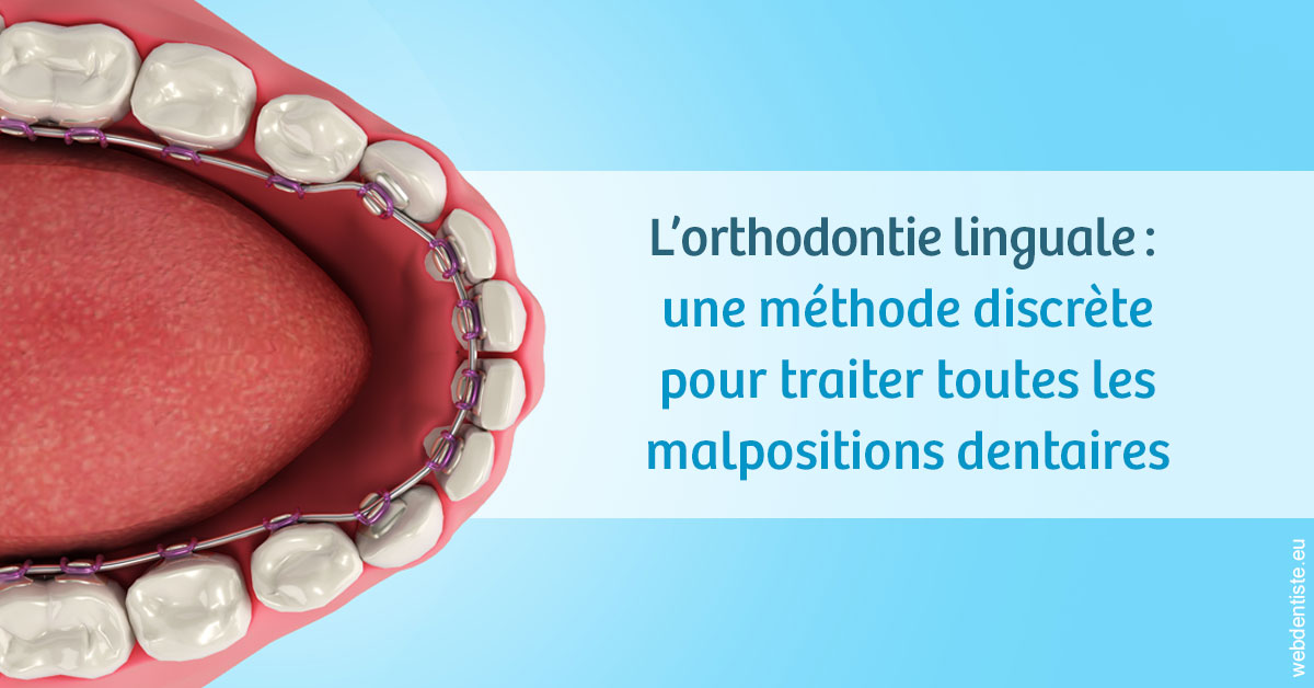 https://dr-domngang-olivier.chirurgiens-dentistes.fr/L'orthodontie linguale 1