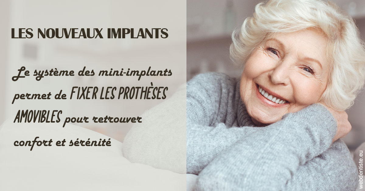https://dr-domngang-olivier.chirurgiens-dentistes.fr/Les nouveaux implants 1