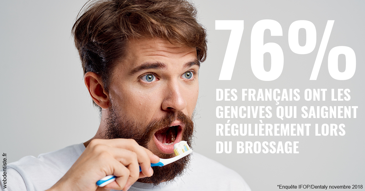 https://dr-domngang-olivier.chirurgiens-dentistes.fr/76% des Français 2
