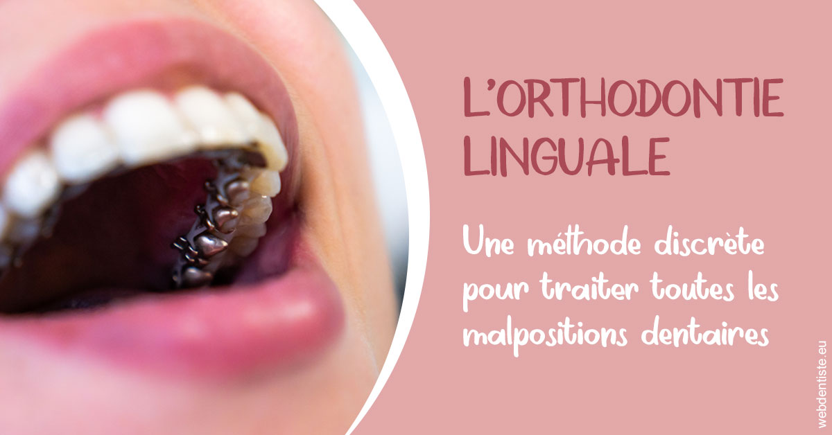 https://dr-domngang-olivier.chirurgiens-dentistes.fr/L'orthodontie linguale 2