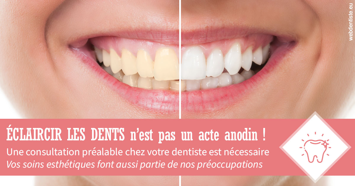 https://dr-domngang-olivier.chirurgiens-dentistes.fr/Eclaircir les dents 1