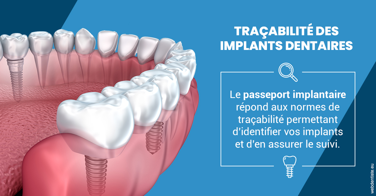 https://dr-domngang-olivier.chirurgiens-dentistes.fr/T2 2023 - Traçabilité des implants 1