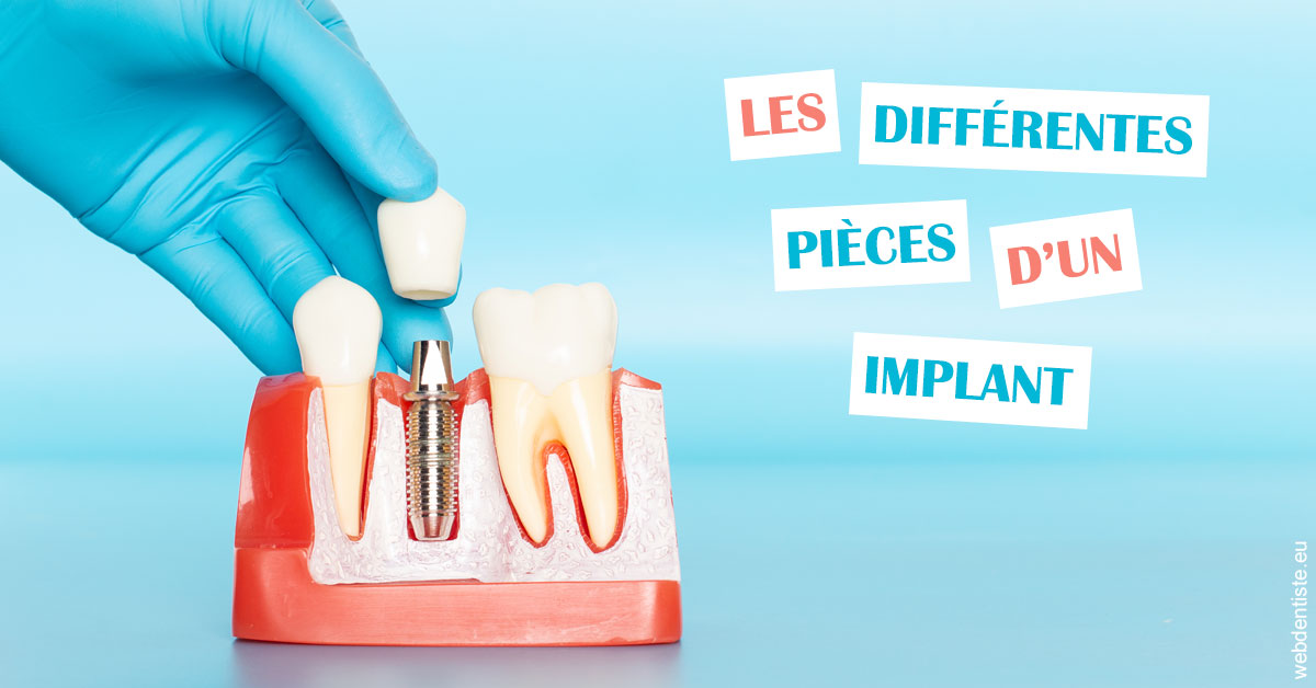 https://dr-domngang-olivier.chirurgiens-dentistes.fr/Les différentes pièces d’un implant 2
