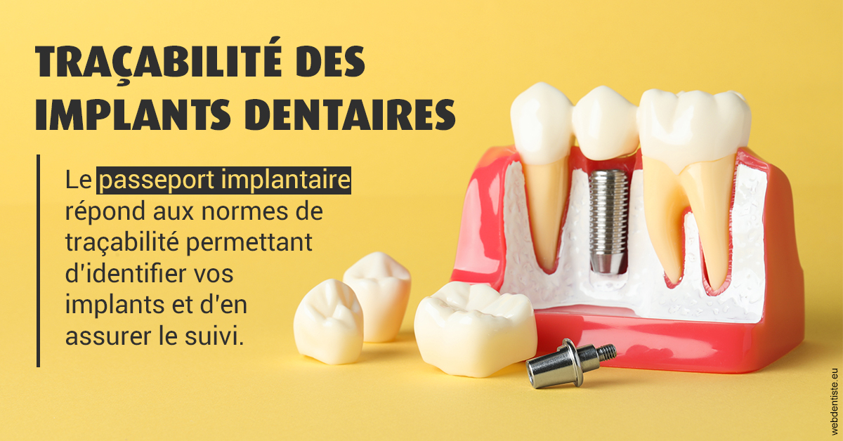 https://dr-domngang-olivier.chirurgiens-dentistes.fr/T2 2023 - Traçabilité des implants 2