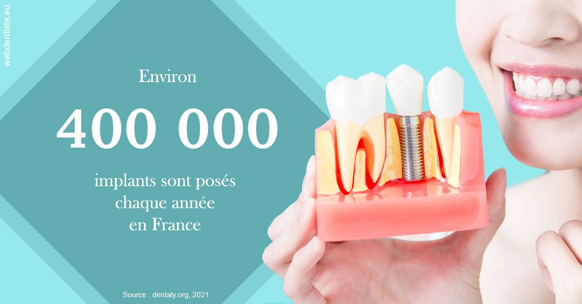 https://dr-domngang-olivier.chirurgiens-dentistes.fr/Pose d'implants en France 2
