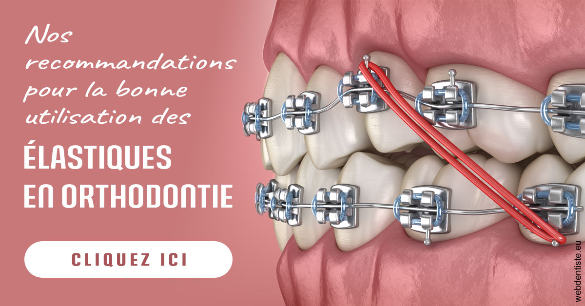 https://dr-domngang-olivier.chirurgiens-dentistes.fr/Elastiques orthodontie 2
